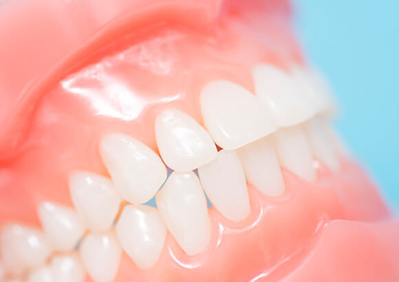 歯の負担軽減